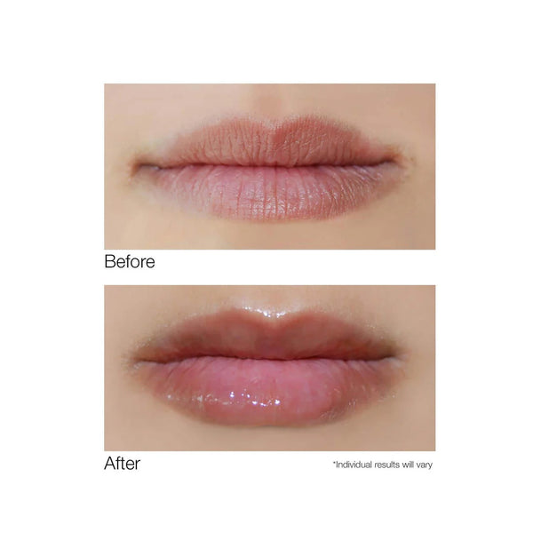 Dermelect Smooth Lip Volumizer