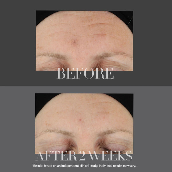 Kate Somerville KateCeuticals Firming Serum with Tri-Peptide + Hyaluronic Acid Complex